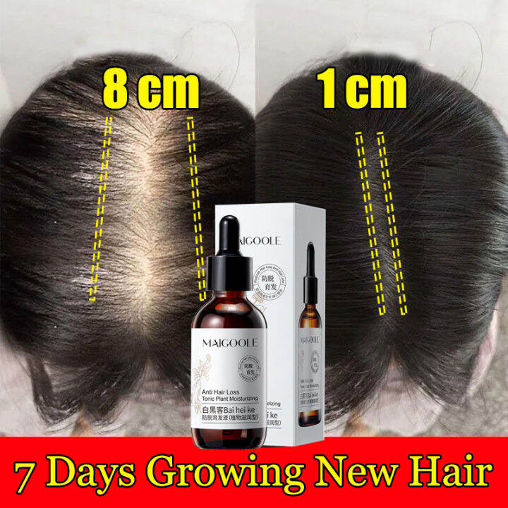 hair growth serum Antihair loss treatment Hair loss tonic 脱发护理 Ginger