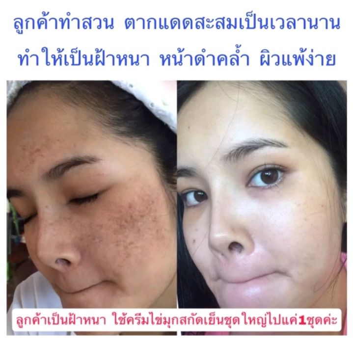 พร้อมส่ง-ของแท้-ครีม-ไข่มุก-ไวท์เทนนิ่ง-onw-50กรัม-หน้าขาวไว-หน้าใส-ลดฝ้า-ลดกระ-ลดจุดด่างดำ-ลดริ้วรอย-ลดรูขุมขน