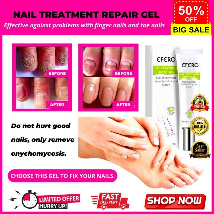 💯 ORIGINAL Safe Effective EFERO Nail Treatment Repair Gel Feet Care Bright Nail Armor Repair
