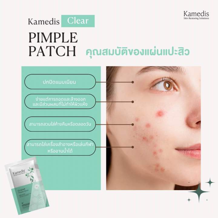 clear-pimple-patch-แผ่นแปะสิว-ลดอาการอักเสบ