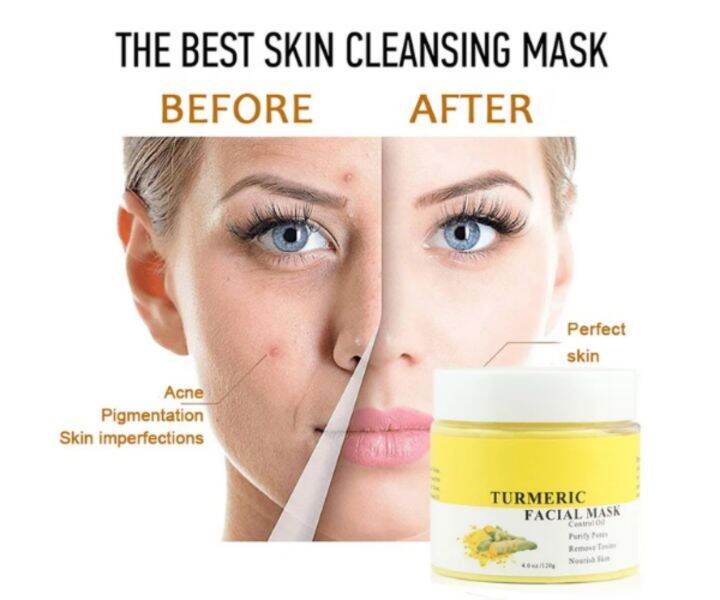 AE TURMERIC CREAM/ FRAGRANCEFREE, Eczema, Acneprone, Dry skin