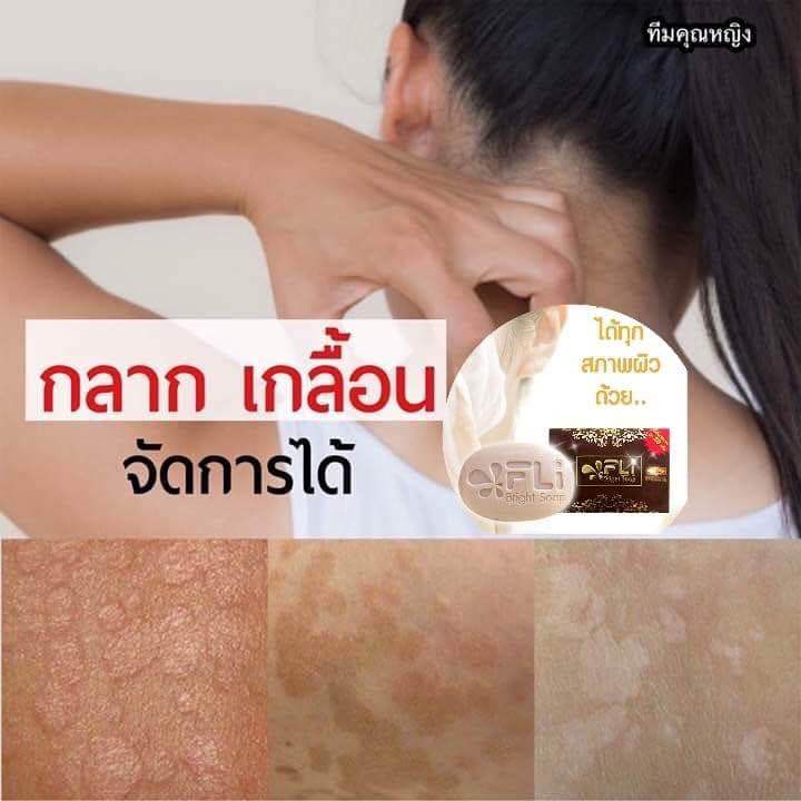 จะดีสักแค่ไหน-ถ้าเจอสบู่ที่ใช่สำหรับผิวคุณ-สบู่สมุนไพร-fli-bright-soap-เหมาะสำหรับทุกสภาพผิว-อุดมไปด้วยสารสกัดจากธรรมชาติ-ใช้ได้ทั้งผิวหน้าและผิวกาย-สต๊อกแน่นมาก-ขายดีสุดๆ