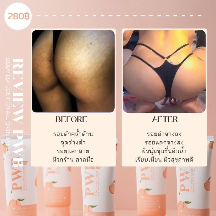 pwb-เลิกก้นดำด้าน-ครีมทาก้น-pwb-ใช้จริง-รีวิวจริง100-ครีมลดรอยจุดด่างดำ-ลดรอยแตก