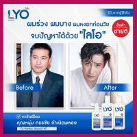 สินค้าพร้อมส่ง ?ครีมนวด+แชมพู?LYO ไลโอ ลดผมร่วง แก้ผมบาง ชะลอผมหงอก ผมดกดำ ลดความมันผม  ขจัดรังแค ลดการคันหนังศีรษะ ผมแตกปลาย