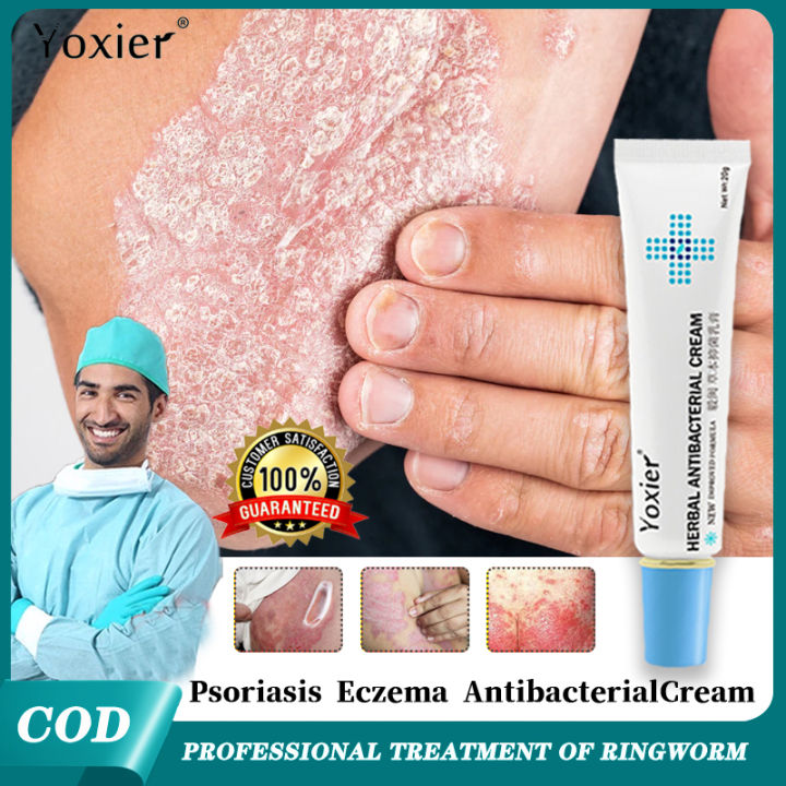 Yoxier Herbal Antibacterial Cream 20g For skin allergies and ringworm ...