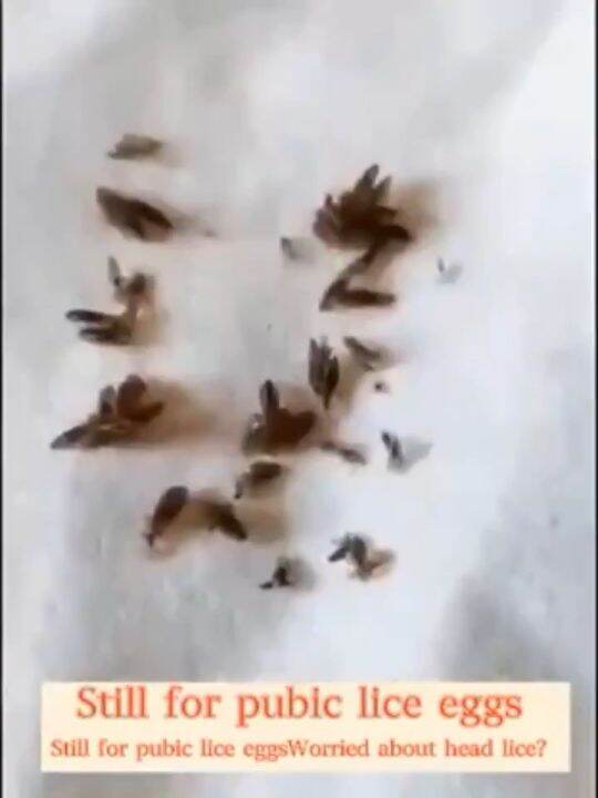 anti lice shampoo for kids lice removal shampoo 120ml Free shower cap grate comb Fast results in