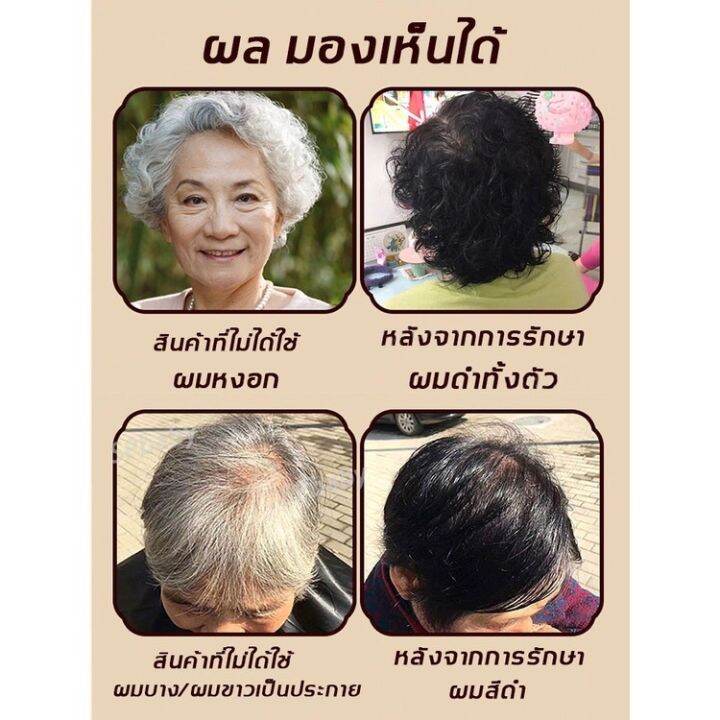 แชมพูปิดผมหงอก-300ml-ผมเงาดำ-ยาสระแก้ผมหงอก-แชมพูแก้ผมหงอก