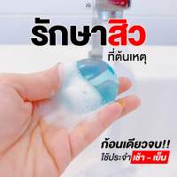 ส่งฟรี สบู่รักษาสิว Zin C Soap ราคาเพียงก้อนละ 39 บาท