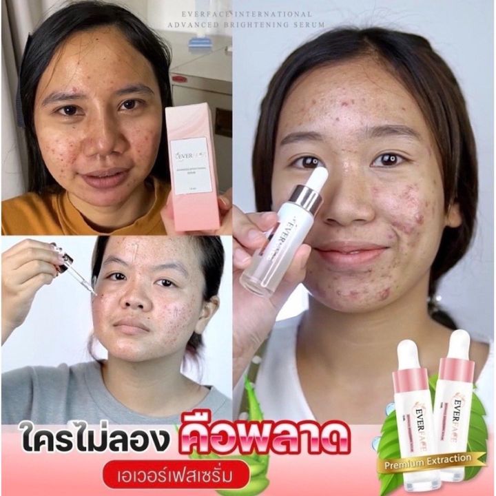 ของแท้-ของแท้-everface-serum-เอเวอร์เฟสเซรั่ม