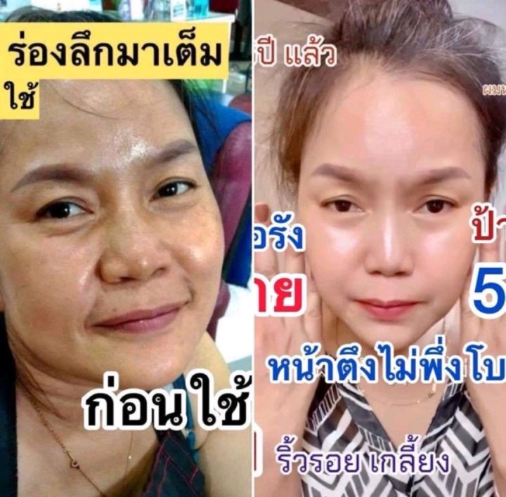 เซรั่มมายา-มายาเซรั่ม-mayaเซรั่ม-เซรั่มmaya-มายาโบท็อก