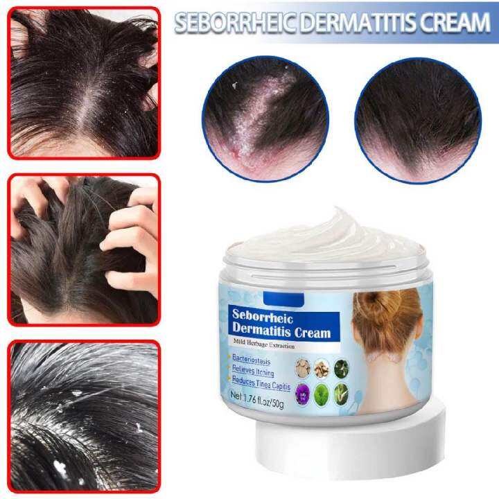 Seborrheic dermatitis cream scalp treatment psoriasis folliculitis ...