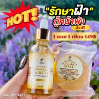 {พร้อมส่งของแท้?} เซ็ต 1แถม1ส่งฟรี!! เซรั่มมาดามแก้ฝ้าหนากระลึก ลดสิว จุดด่างดำ ผิวหน้าฉ่ำอิ่มน้ำ หน้าเด้ง #MadamSerum #Madamcoll