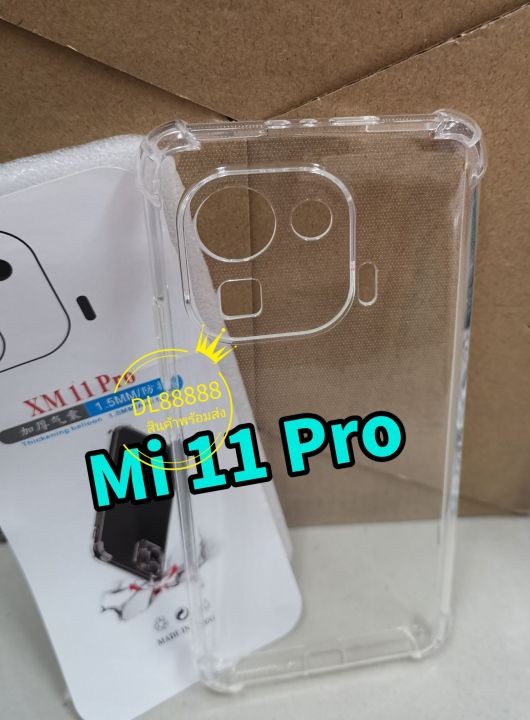 mi11-พร้อมส่งในไทย-เคสใสกันกระแทกคลุมกล้อง-for-xiaomi-mi11-5g-xiaomi-mi11-xiaomimi11-mi11lite-mi11-lite-mi-11-lite-5g-ne-mi-11-pro-mi11pro