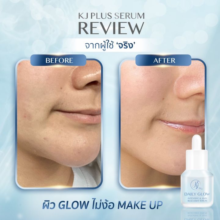 kj-plus-serum-ป้องกันแสงสีฟ้า