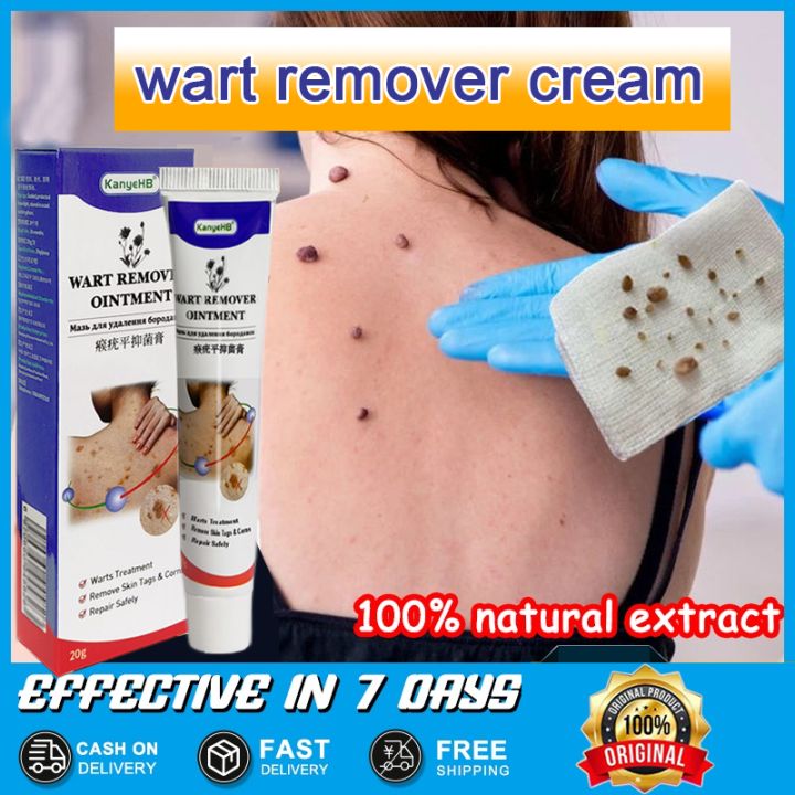 Wart Removal Ointment Body Warts Treatment Cream 20g Skin Mole Removal ...