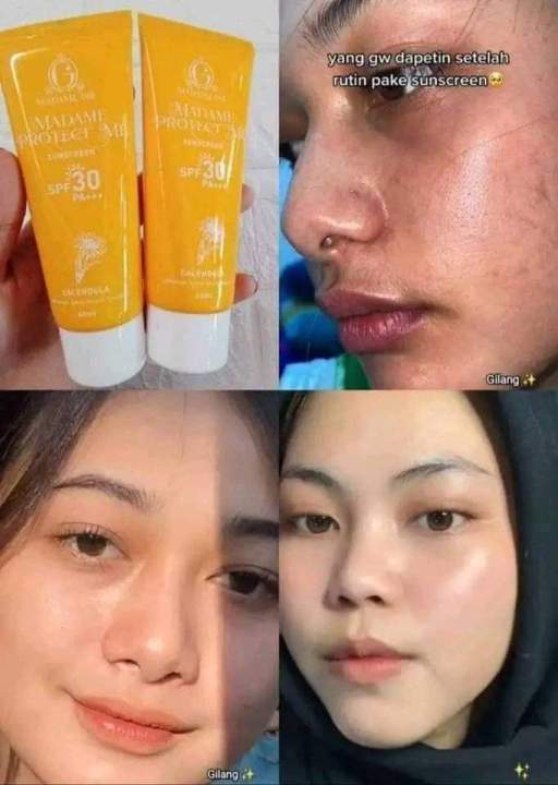 Sunscreen Madamgie Spf30pa+++ Bikin Wajah Glowing Dan Melindungi Dari ...