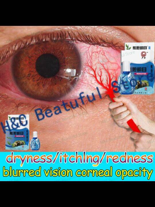 Eye Drops for Eye Care15ml/Brand Eye Drops/mineral eyedrops/Eye Drops