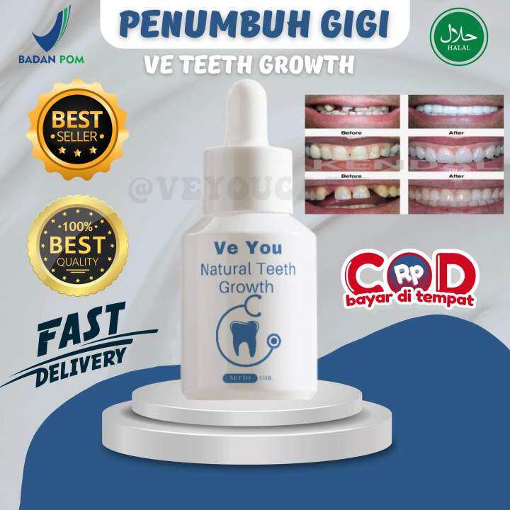 Penumbuh Gigi VE TEETH Penumbuh Gigi Berlubang, Gigi Ompong, Gigi Patah