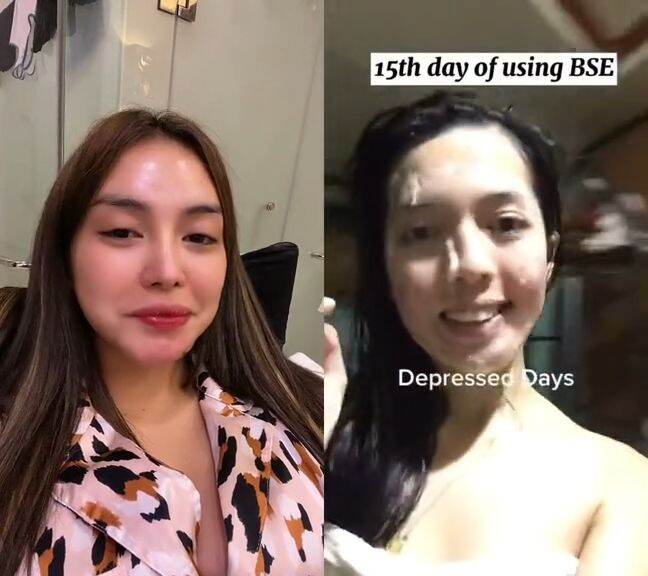 Brilliant Skin Essentials Set Whitening Skin Moisturizer Rejuvenating