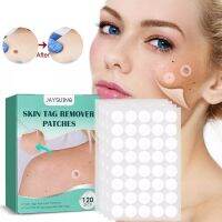 Skin Tags Remover Patches 120 ชิ้น  แผ่นแปะสิว