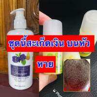 แชมพูนางพญา NangPhaya ซื้อ1 แถม 3 เซรั่มบอระเพ็ด หมดปัญหาคันศรีษะ เชื้อรา ชันตุ ผมบาง มีสวนผสมสารสกัดธรรมชาติ 12 ชนิดของแท้100% เห็นผลจากผู้ใช้จริงมาแล้วต้องลองโปรพิเศษวันนี้