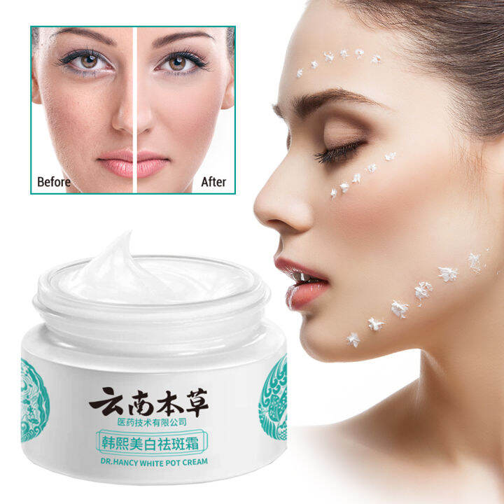 Whitening Freckle Cream Arbutin Niacinamide Remove Melasma Dark Spots ...