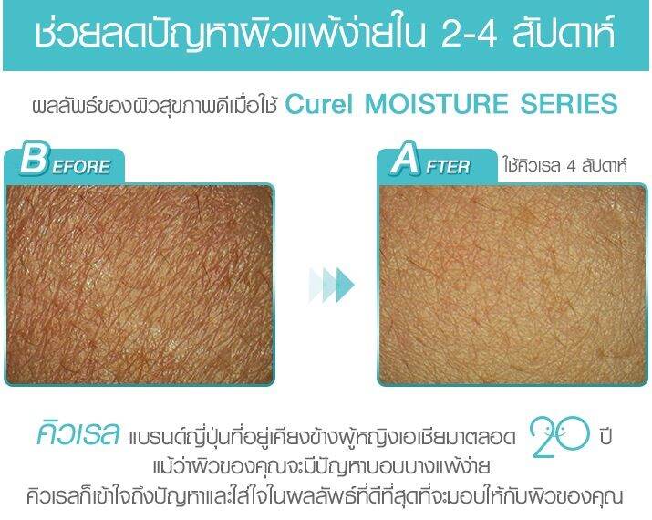 curel-intensive-คิวเรล-moisture-whitening-aging-care-ครีมบำรุงผิวหน้า-ผิวบอบบางแพ้ง่าย-ขนาด-40g