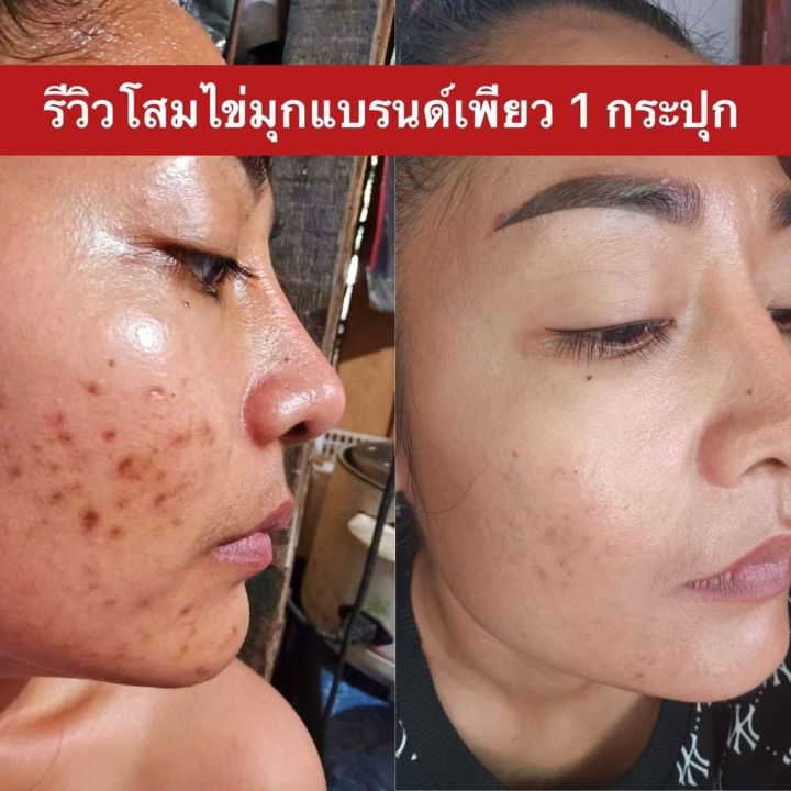 พร้อมส่ง-ครีมโสมไข่มุก-เซรั่มฮายัง-ครีมคาโมมายด์-แบรนด์เพียว-ครีมโสมไข่มุกเกาหลี-หน้าเงา-ลดสิว-ฝ้า-หน้าขาว-โสมไข่มุกคอลลาเจน-pure