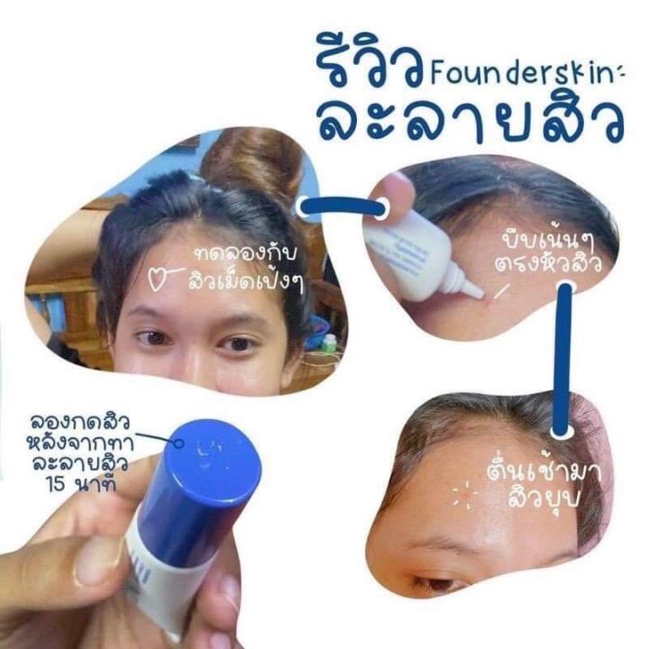 founderskin-vitamin-anti-acne-ฟาวเดอร์สกินตัวช่วยสำหรับผู้ที่มีปัญหา