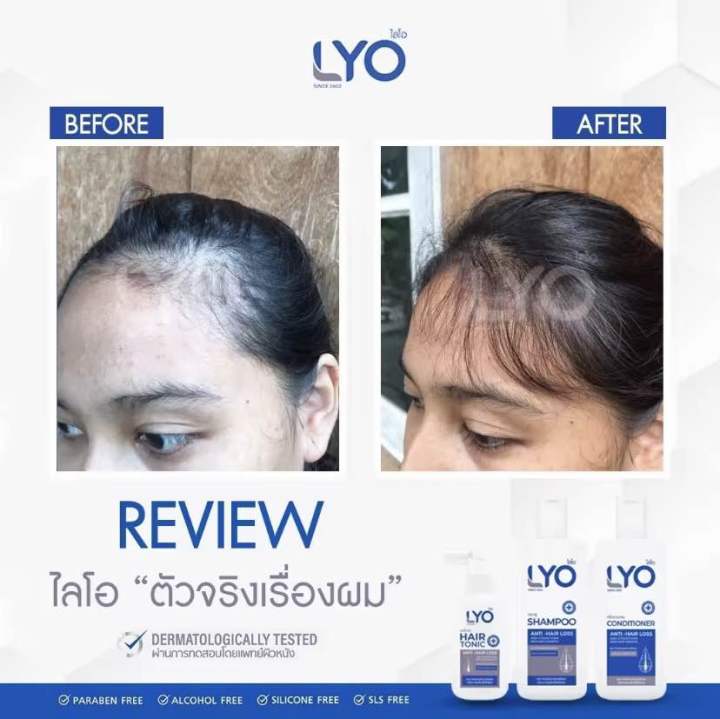 lyo-hair-tonic-แฮร์โทนิค-พี่หนุ่มกรรชัย-หยุดร่วง-หยุดบาง-กระตุ้นการเกิดใหม่-ให้ผมกลับมาดูดีอีกครั้ง