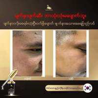 ဟိတ္ဟိတ္  တကယ္စြဲသုံးရင္ တကယ္ေပ်ာက္တဲ့ GDB serumေလးၾကည့္? 

မ်က္ႏွာမွာ ဝက္ၿခံ  အမဲစက္ေတြရွိေနရင္ ဒီserumေလးနဲ႔အျမစ္ဖ်က္ 

တင္းတိပ္ မွဲ႕ေျခာက္ေတြရွိေနရင္လည္း ဒီserumေလးစြဲသုံးၿပီး အကုန္ကြာက်သြားေအာင္လုပ္ 

အဆီဖုေတြ ဆားဝက္ၿခံေတြ ေခၽြးေပါက္က်ယ္တာေတြရွိေနရင္