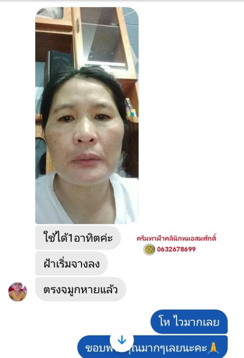 ส่งฟรี-คู่ครีมรักษาฝ้า-หน้าเด็ก-คลินิกหมอสมศักดิ์-นายแพทย์สมศักดิ์-คุณจักร