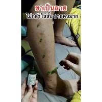 ครีมลดขาลาย  Bioscarไบโอสการ์ ลบแผลเป็น
ตุ่ม รอยสิว แผลเป็น น้ำเหลืองไม่ดี ผิวแพ้ง่ายใช้ได้ !!

ปรับผิวขาว เรียบเนียน ลบรอย 
เข่าดำ ศอกดำ คอดำ ต้องใช้
เซรั่มเข้มข้น เห็นผลไว 

หมายเลขใบอนุญาต/อย. 55-1-6500020182
วันหมดอายุ 15/2/2569