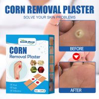 12แผ่น/กล่อง Corn Wart Remover Plaster Canopy Patch Medical Adhesive Patch Medical Plaster Corn Removal เห็นผลทันทีเมื่อใช้ต่อเนื่อง ตาปลาพลาสเตอร์ พลาสเตอร์หูดตาปลา พลาสเตอร์ติดตาปลา ตาปลา