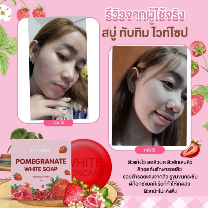 สบู่ทับทิม-white-skin-care-ของแท้-1-ก้อน