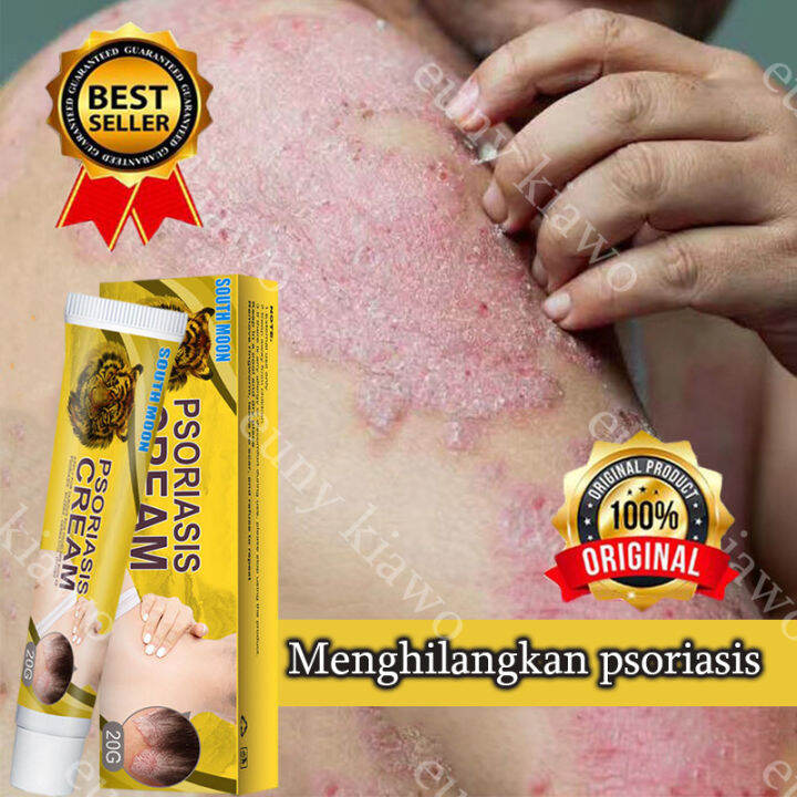 Salep eksim Salep gatal 20G Kulit Kepala Psoriasis Tangan Tinea Kaki