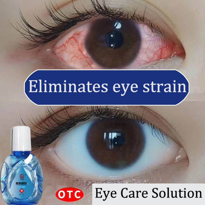 Tired eye Dry eye Refreshes Eye drops Eye Care Solution 15ml Lazada