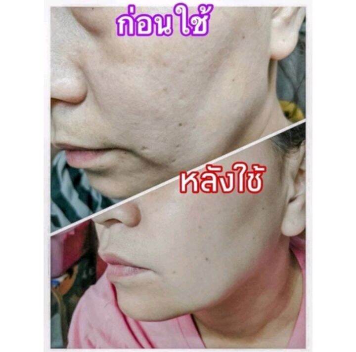 mayaเซรั่ม-mayaโบท็อกซ์-เซรั่มมายา-เซรั่มโบท็อกซ์มายา-เซรั่มโบท็อกซ์maya-เซรั่มโบท็อกซ์-mayaโบท็อก