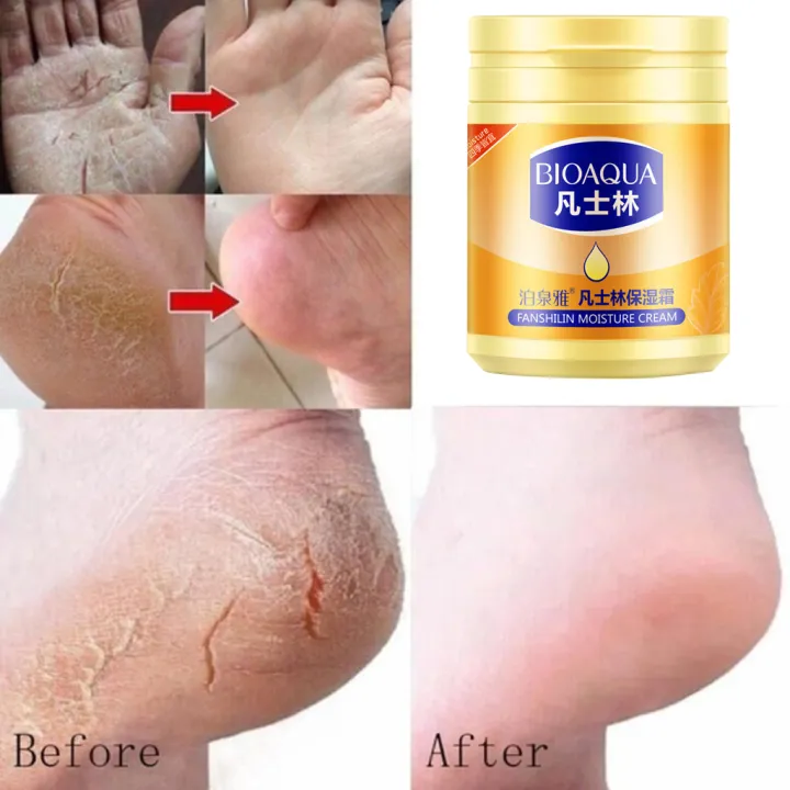 170g Vaseline Moisturizing Cream Original Foot Cream For Dry and Crack