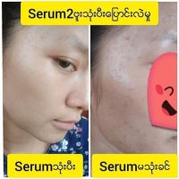 GDB Serum