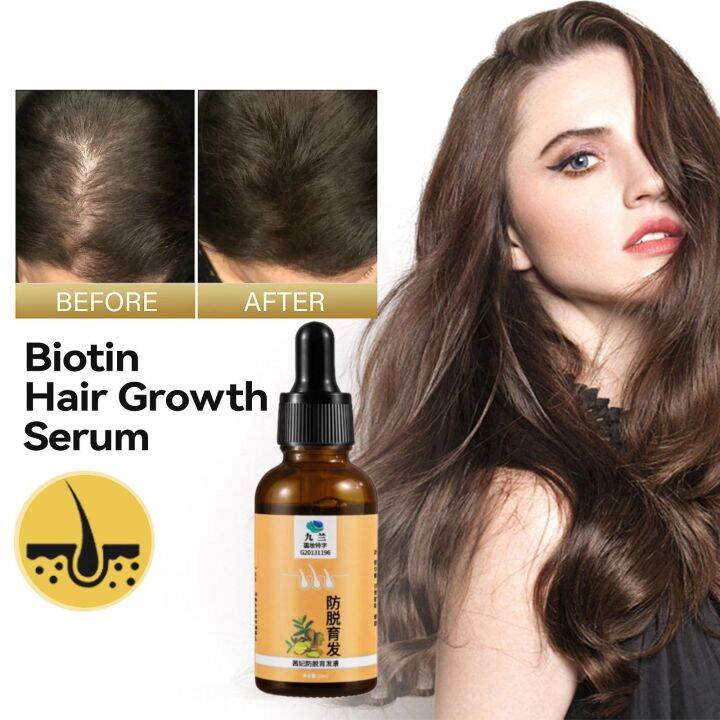 30ml Hair Growth Cream (Helps with Hair Loss, Balding, Bald Spots, Hair ...