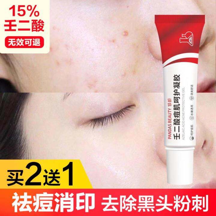Watsons Azelaic Acid Condensate 15 Acne Ointment Acne Removing Acne