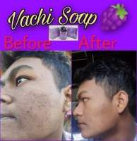 Vachi Soap