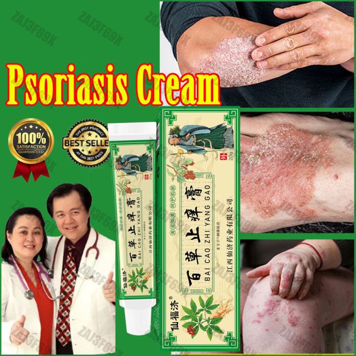 Treatment cream ubat kulit /krim gatal/ubat jerawat/eczema Psoriasis ...