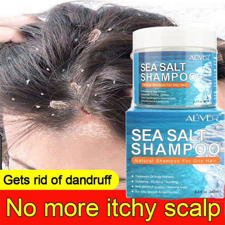 Aliver Sea Salt Anti Dandruff Shampoo For Scalp Itching Psoriasis