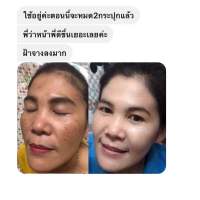 ครีมสาหร่ายสูตรต้นตำรับ โบทานิค 1 แถม1