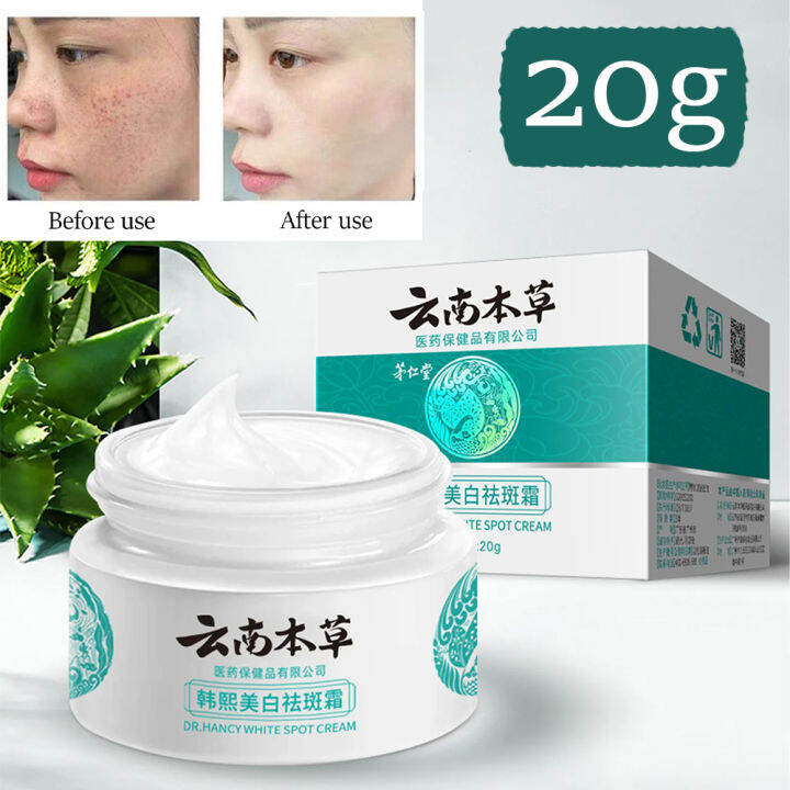 20g Japanese Melasma Cream Melasma Cream From Japan Yunnan Herbal Whitening Freckle Cream