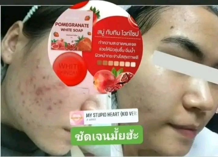 สบู่ทับทิม-white-skin-care-ของแท้-1-ก้อน