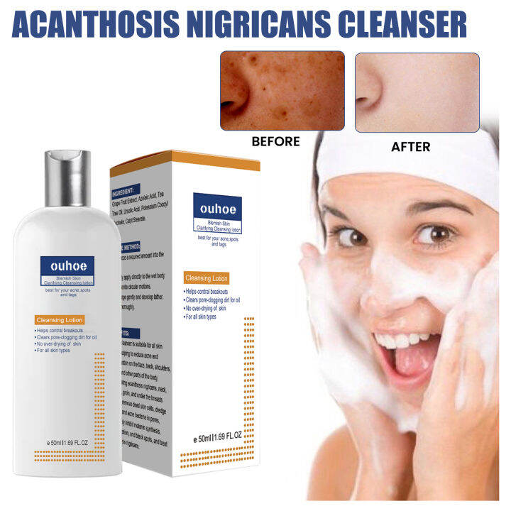 Dark Spot Facial Cleanser Acne Pore Deep Cleansing Canthosis Nigricans