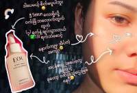 မျက်နှာစိုစိုကြည်ကြည်လေနဲ Glow ချင်ရင် Eou Face Serum လေ တစ်ဘူးဆောင်ထားလိုက်